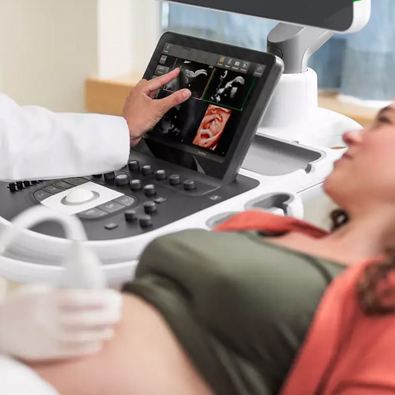 Ультразвуковая система премиального класса Philips EPIQ Elite
